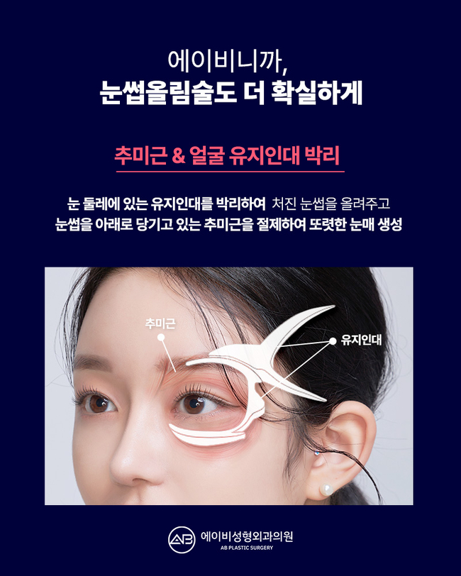 If You’re Still Thinking About a Brow Lift image 4
