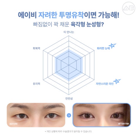 Transparent Adhesion for a Refined Look: AB Plastic Surgery for Attractive Eyes image 2