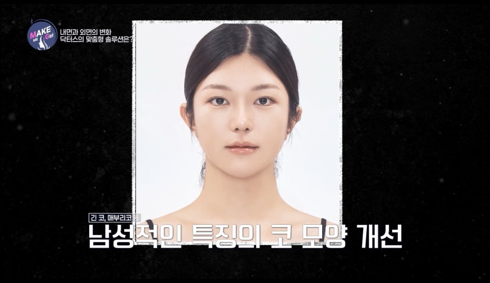 에이비성형외과 관련 이미지 5