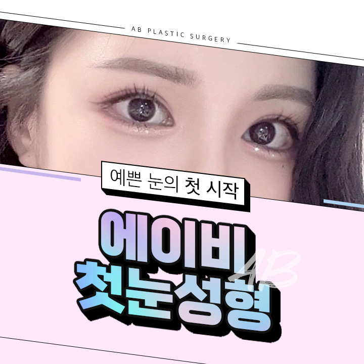 쌍꺼풀수술전후 새로운 결과를 관련 이미지 1