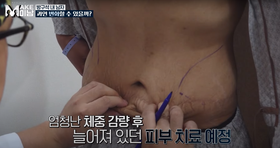 [AB Plastic Surgery Featured on Broadcast] LG HelloVision & KBSjoy image 11