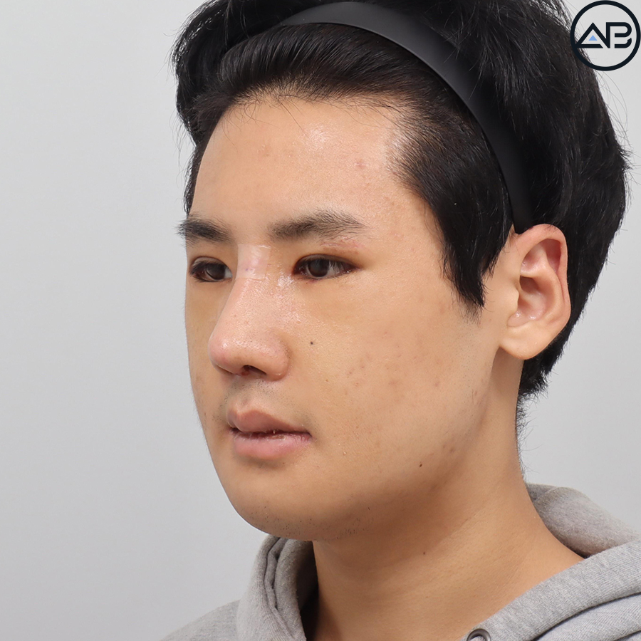 AB Plastic Surgery, MAKEmiNamn Broadcast Afterlife Update_방구석내남자 image 4