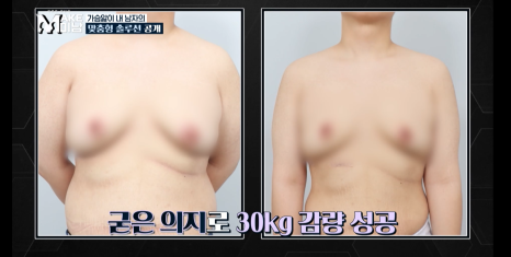 [에이비성형외과 방송출연] LG헬로비전&KBSjoy 관련 이미지 23
