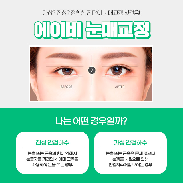 여자무쌍눈매교정 기대해도 좋아 관련 이미지 2