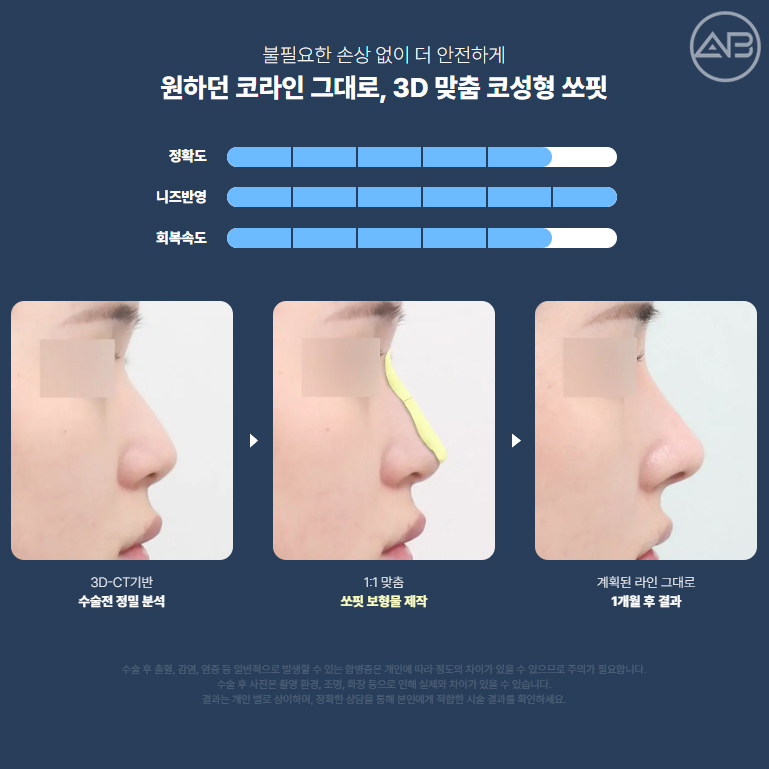에이비성형외과 쏘핏 맞춤보형물 코성형 궁금증 해결하기 관련 이미지 2