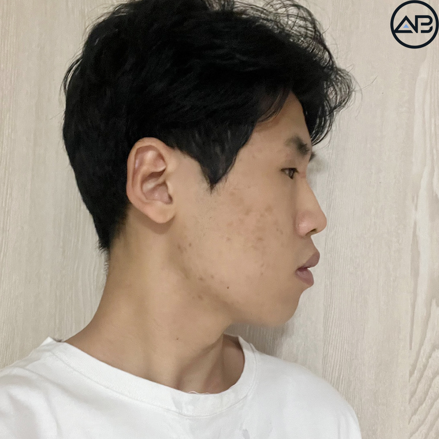 AB Plastic Surgery, MAKEmiNamn Broadcast Afterlife Update_방구석내남자 image 7