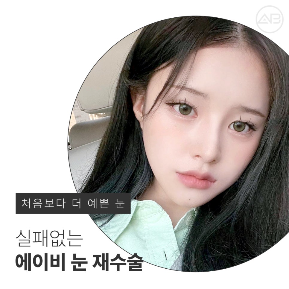 에이비성형외과 쌍꺼풀 짝눈 눈재수술종류 전후 관련 이미지 10