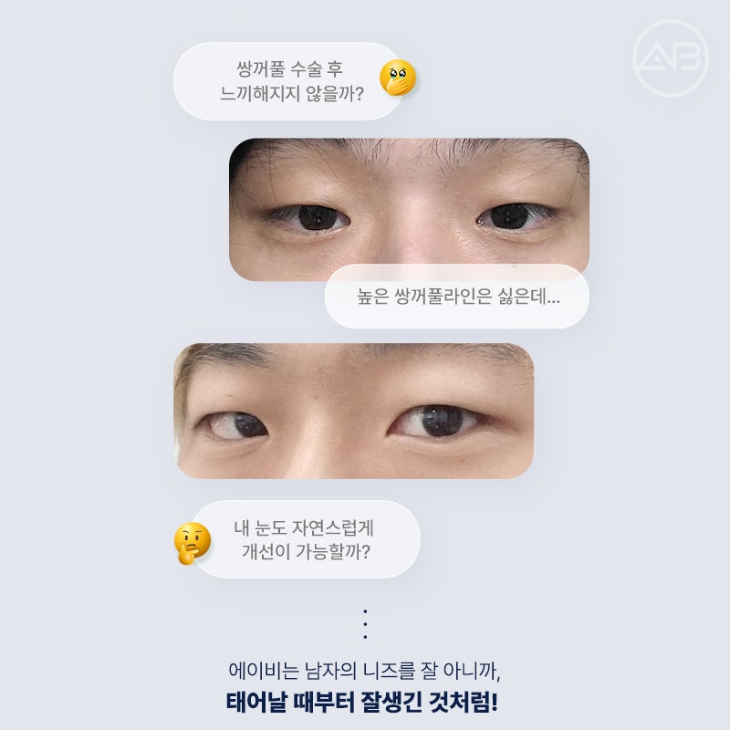 인상을 바꾸는 첫 시작, 에이비성형외과 남자눈성형 관련 이미지 2