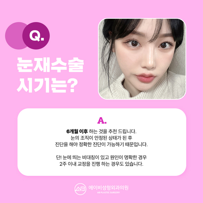 When Is the Right Time for Double Eyelid Revision Surgery? image 5