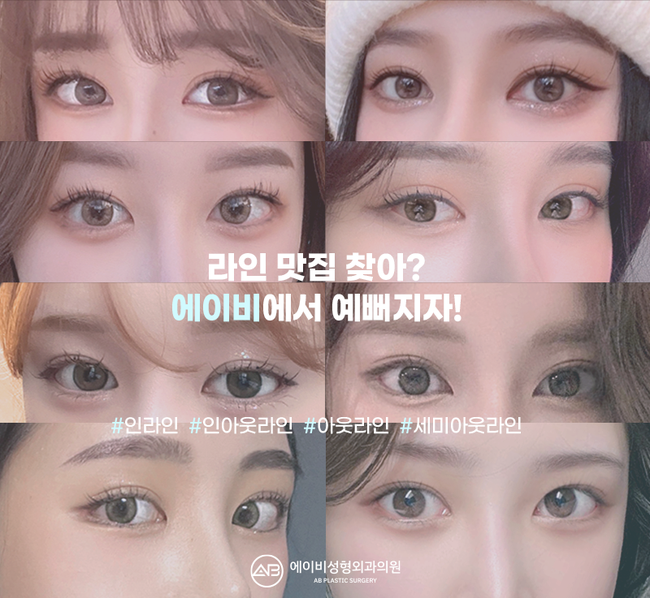 If You’re Looking for a Glamorous Double Eyelid Surgery, AB Plastic Surgery image 7