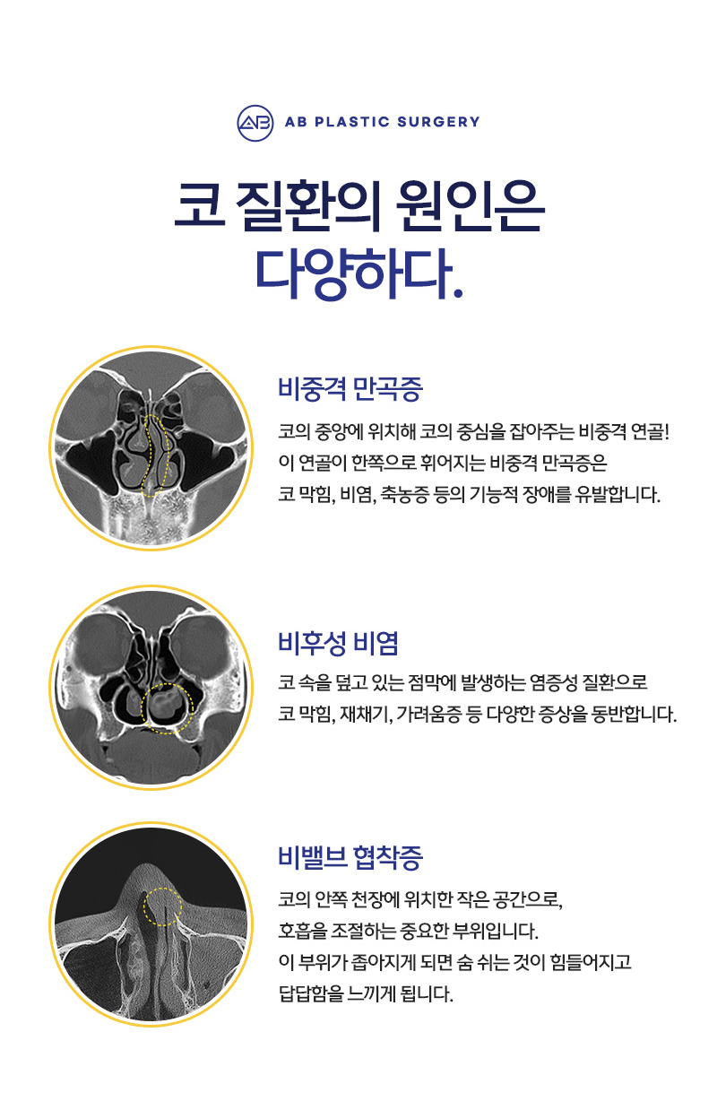 Before and After Male Functional Nose Surgery Are on a Whole Different Level image 3