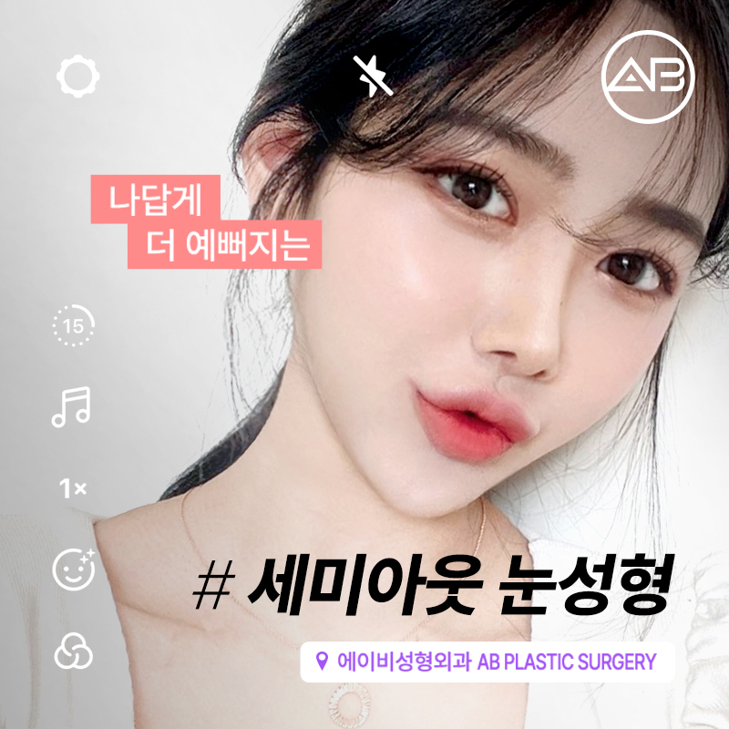 요즘 대세 세미아웃 눈성형 성공하려면? 관련 이미지 12