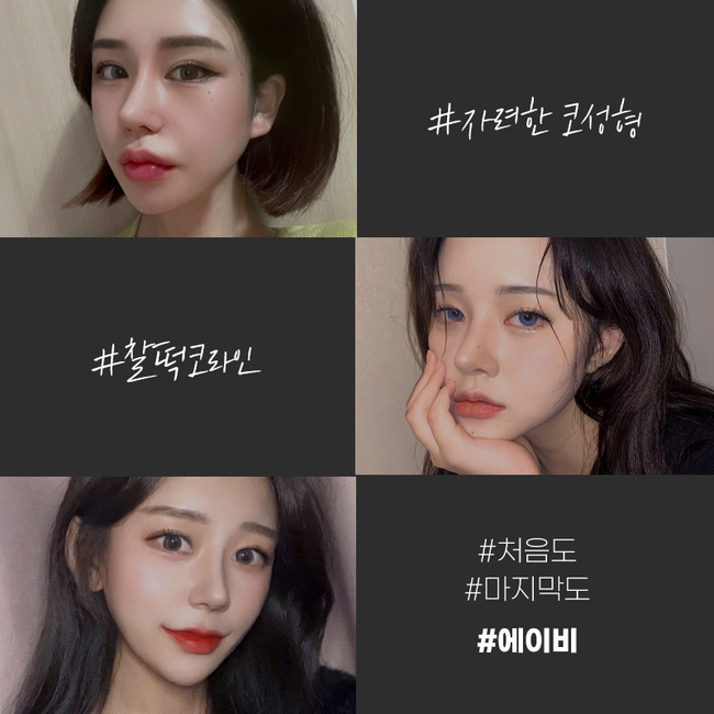 코수술후기 많은 에이비성형외과 관련 이미지 7