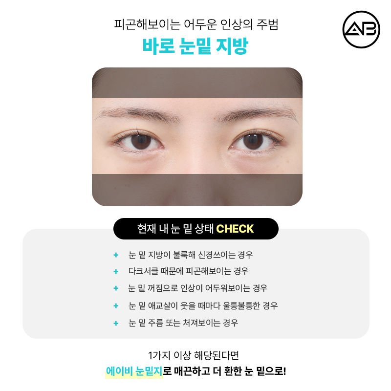 에이비성형외과의원 눈밑지방재배치 눈밑지 수술 방법 후기 관련 이미지 2
