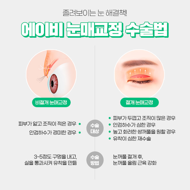 여자무쌍눈매교정 기대해도 좋아 관련 이미지 4