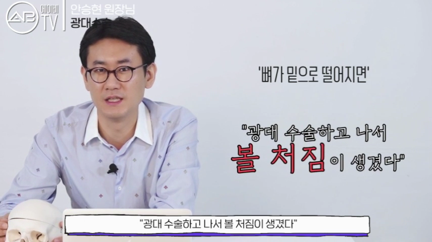 강남에이비성형외과 #유튜브 #에이비TV #광대수술 #광대축소술 관련 이미지 5