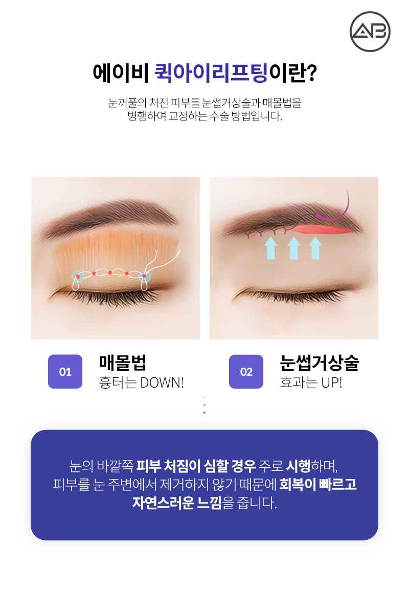 중년눈성형 퀵아이리프팅 하나면 끝 관련 이미지 2