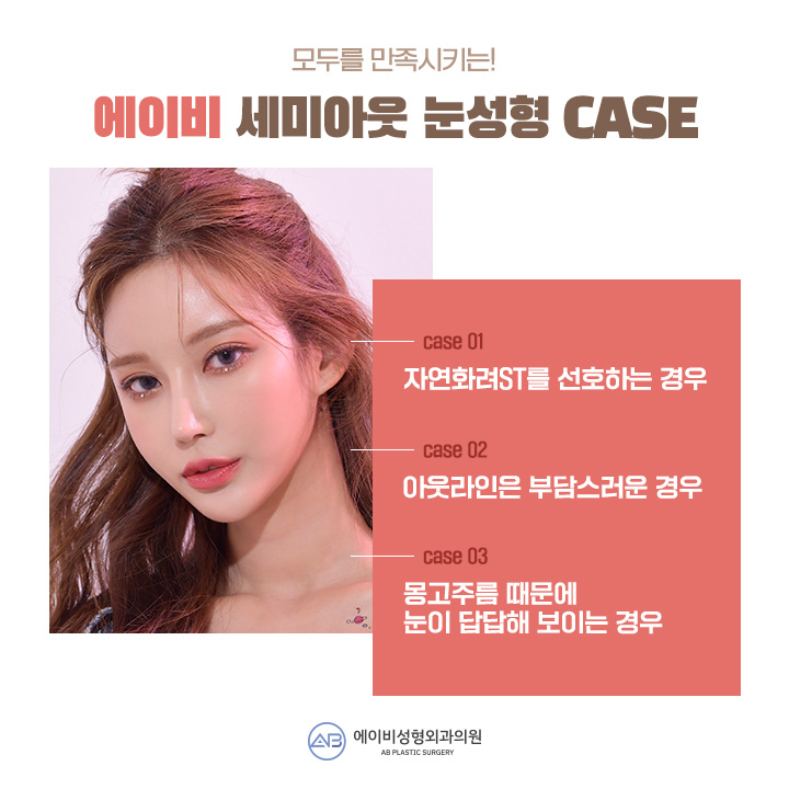 세미아웃눈성형 차이가 있어 관련 이미지 6