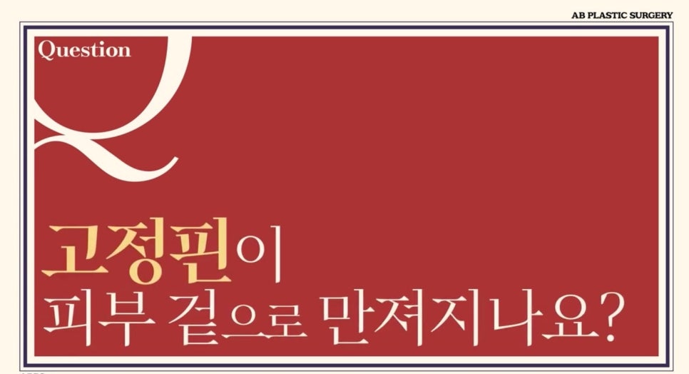 #에이비성형외과#에이비tv#안면윤곽#고정핀 관련 이미지 3