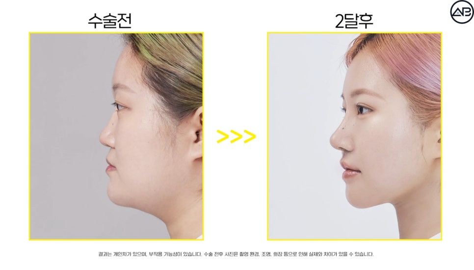 에이비성형외과 관련 이미지 21