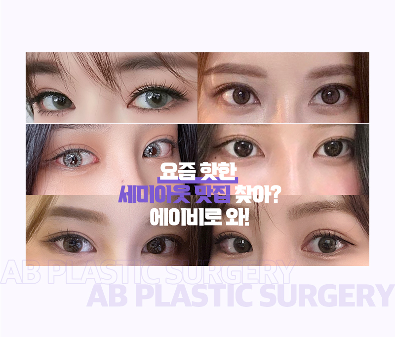 Experience Semi-Out Double Eyelid Surgery at AB Plastic Surgery image 5