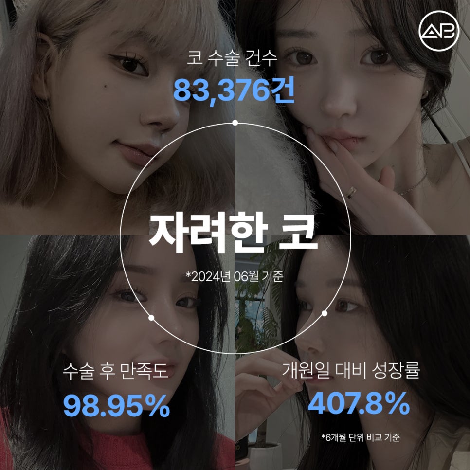 What Are the Special Points of AB Plastic Surgery’s Stylish Nose Surgery? image 3
