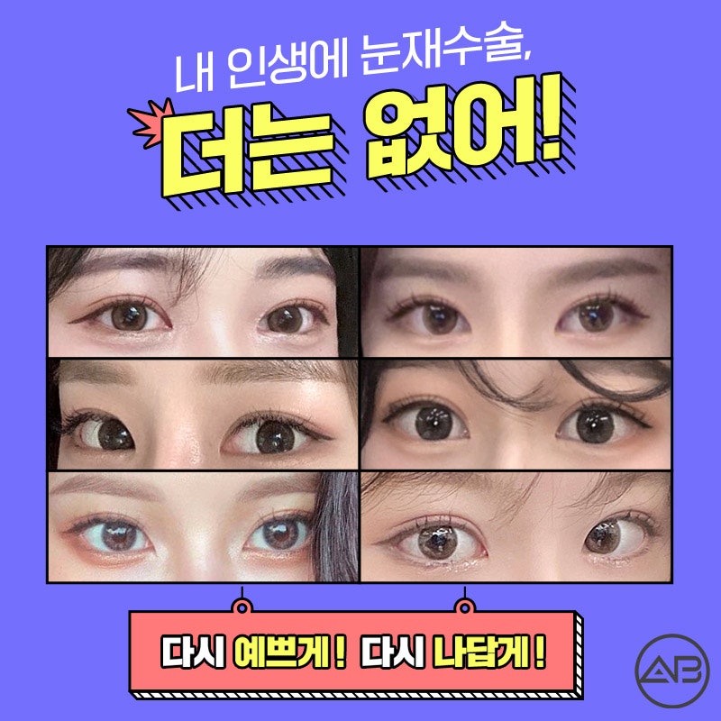 What Is AB Plastic Surgery Like for Double Eyelid Revision Surgery Reviews? image 3