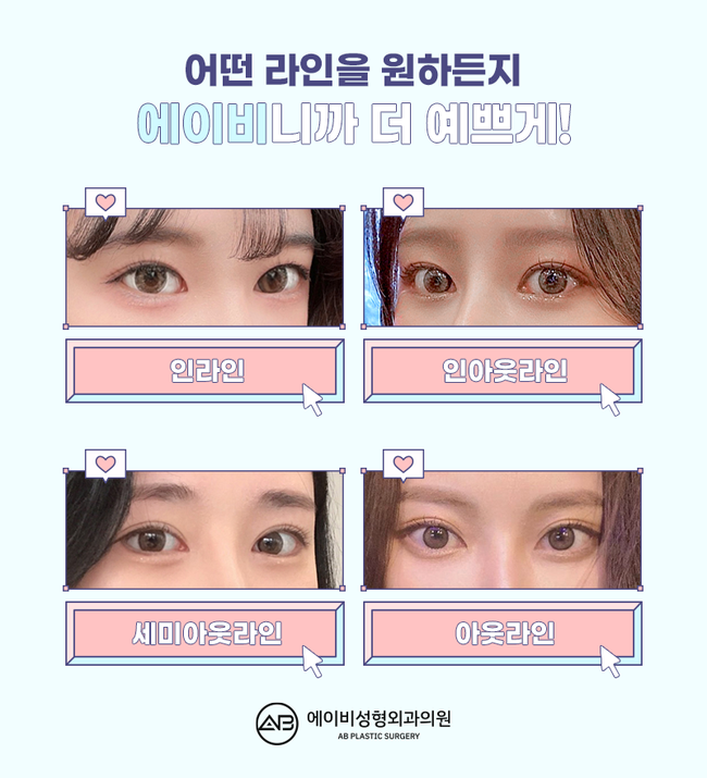 If You’re Looking for a Glamorous Double Eyelid Surgery, AB Plastic Surgery image 5