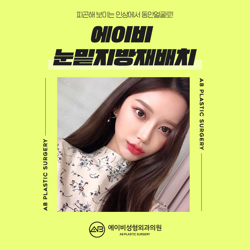 눈밑지방재배치수술 제대로 알고하자 관련 이미지 1