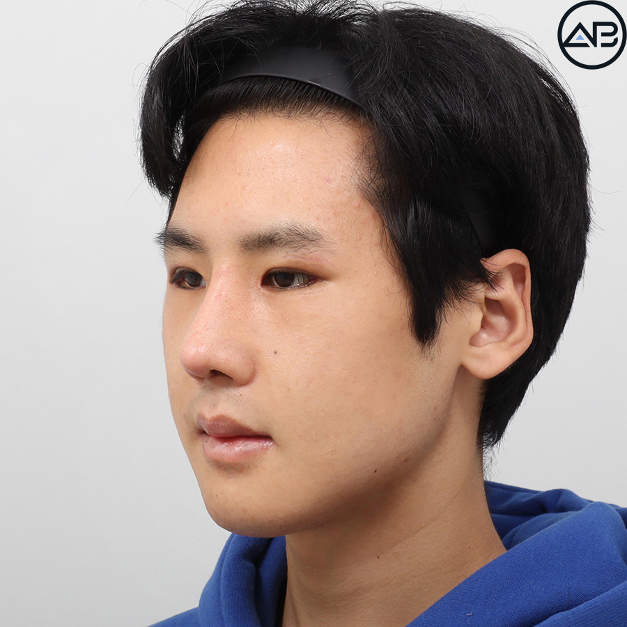 AB Plastic Surgery, MAKEmiNamn Broadcast Afterlife Update_방구석내남자 image 5