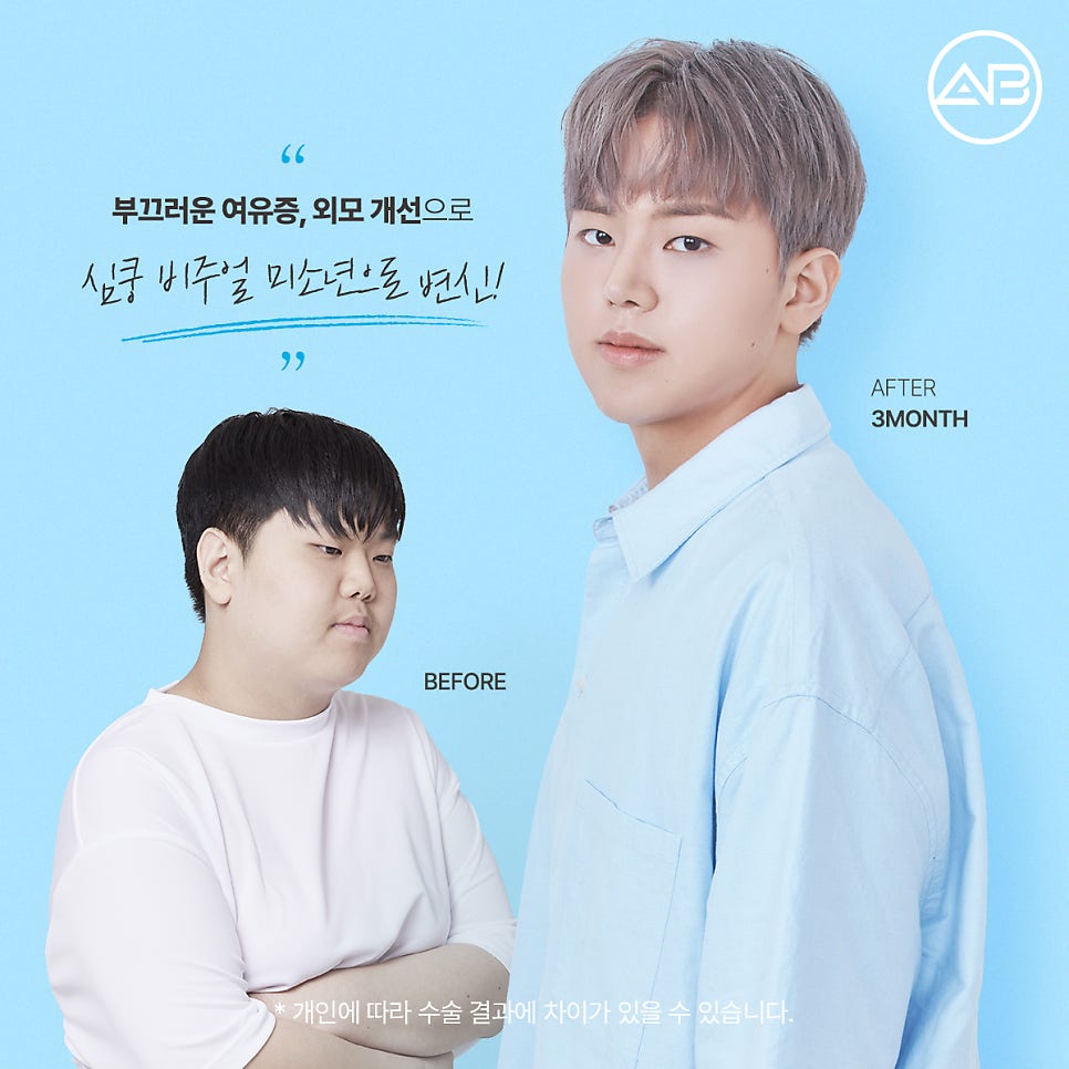 AB Plastic Surgery on MAKE미남 Episode 7 - Looking into the Short Nose Surgery for Gaseum Aen I Nae Namja! image 8