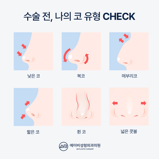 코성형비용 에이비성형외과에서 확인해봐 관련 이미지 3
