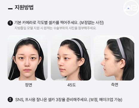 자연스러운 변화 원한다면 에이비성형외과 리얼모델 신청하기 ✨ 관련 이미지 2