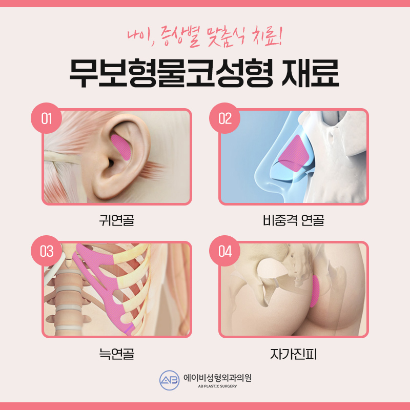 무보형물코성형 이렇게나 달라 관련 이미지 3