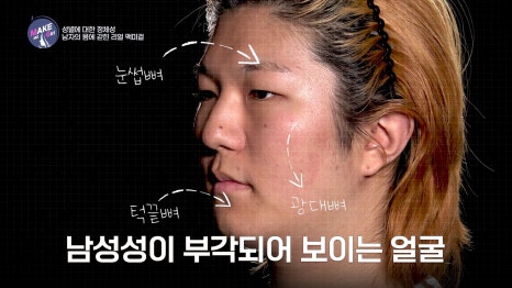에이비성형외과 관련 이미지 3