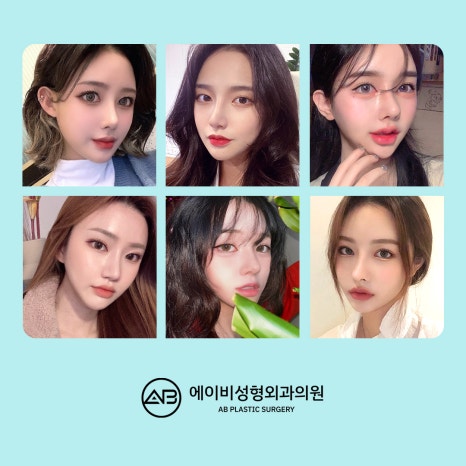 Q. 코성형 하면 팔자주름이 심해지나요? 관련 이미지 2