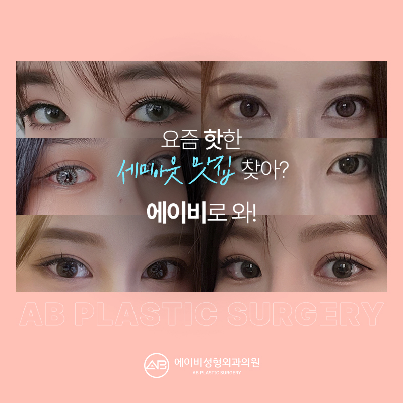 요즘 대세 세미아웃 눈성형 성공하려면? 관련 이미지 11