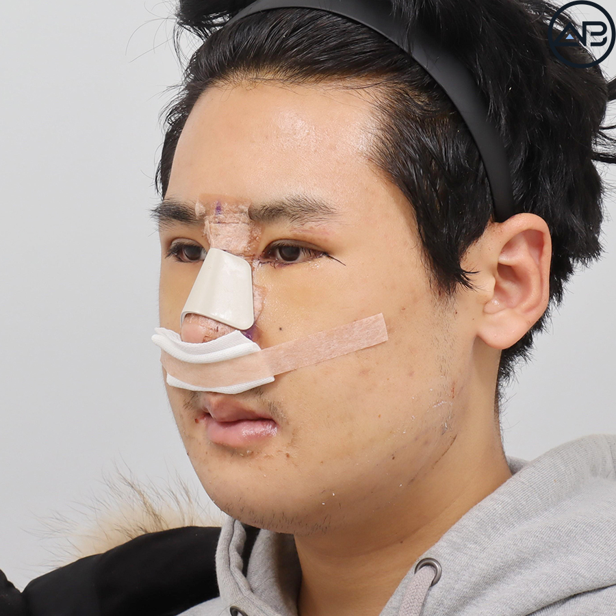 AB Plastic Surgery, MAKEmiNamn Broadcast Afterlife Update_방구석내남자 image 3