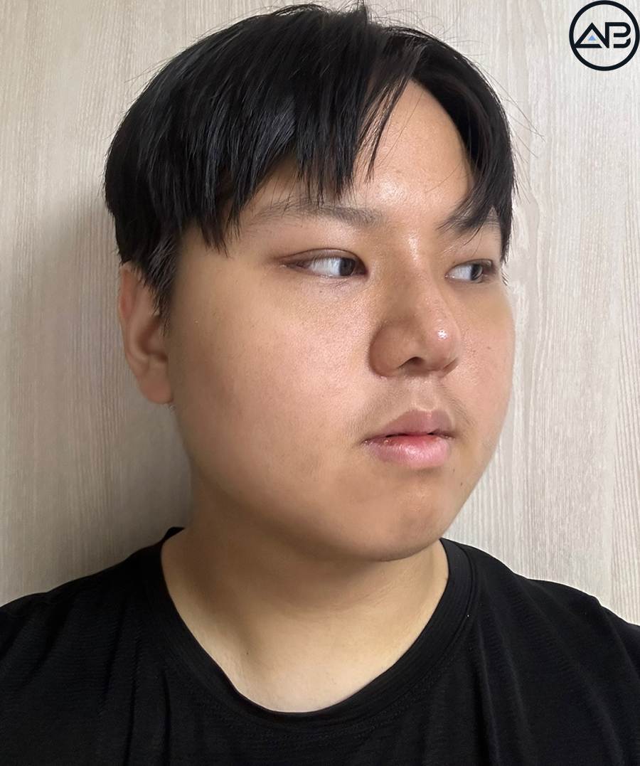 에이비성형외과 맥미남(MAKE미남) 방송이후 근황_가슴앓이내남자 관련 이미지 5