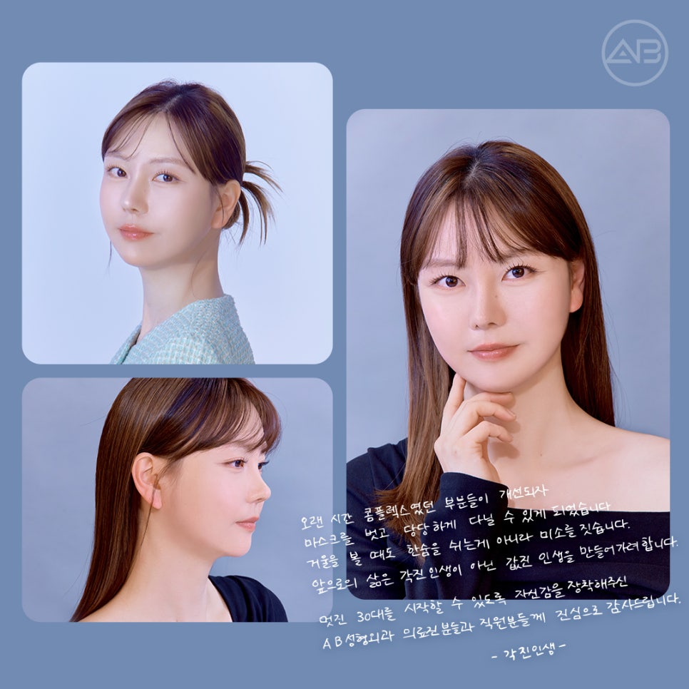 AB Plastic Surgery Contracted Nose Autologous Rib Short Nose Revision Correction Before and After image 8