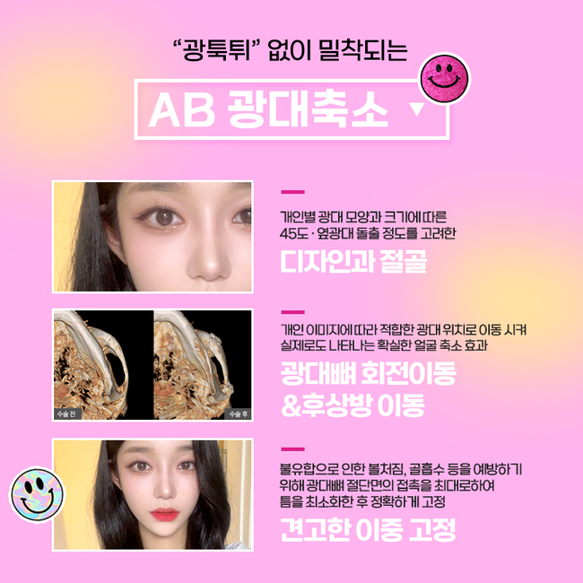 안면윤곽잘하는곳 어떻게 알아봐야할까요? 관련 이미지 3