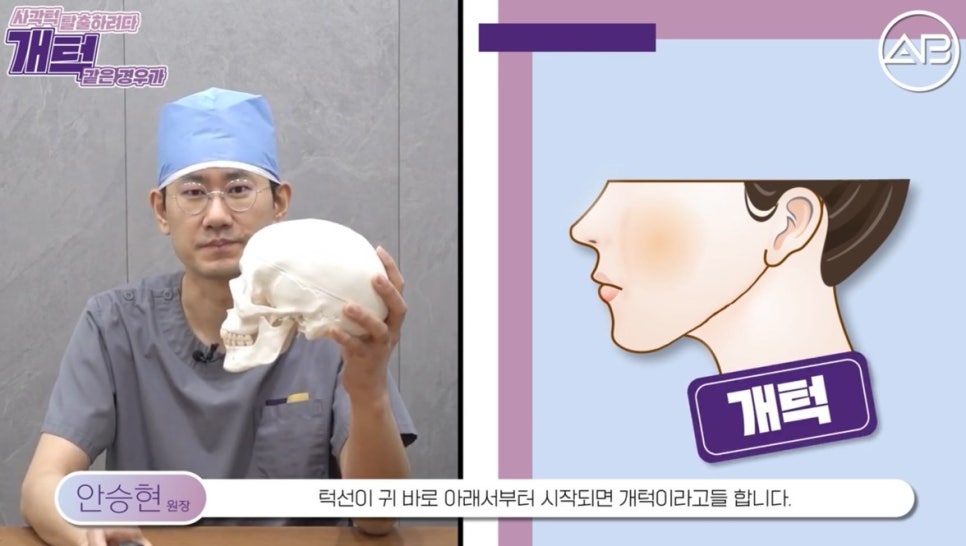 #에이비성형외과#에이비tv#안면윤곽#사각턱 관련 이미지 1