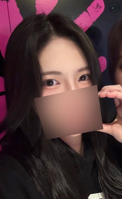 비절개눈매교정+앞트임+뒤트임+밑트임 성형케이스 리뷰 관련 이미지 8