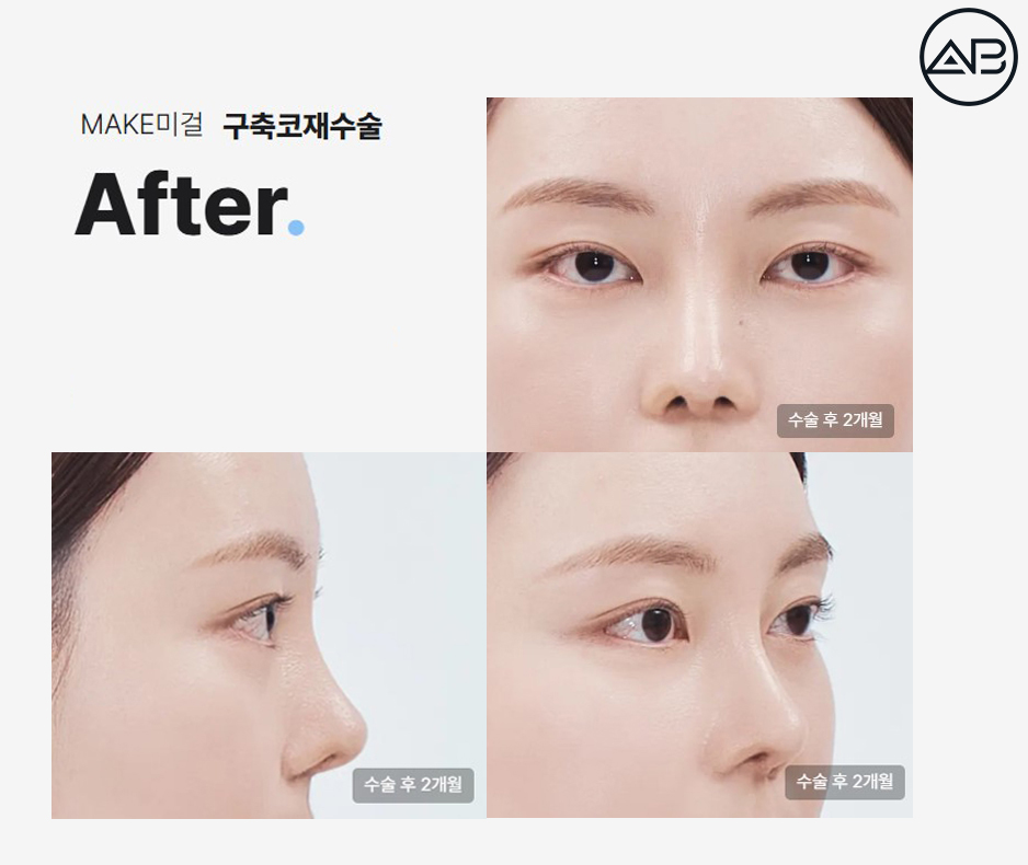 AB Plastic Surgery image 7