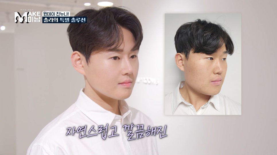 에이비성형외과 맥미남(MAKE미남)9회 - 민원유발내남자 짧은코수술, 매부리코수술 알아보기! 관련 이미지 4