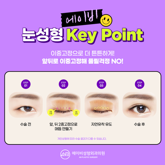 AB Plastic Surgery for First-Time Eye Surgery image 3