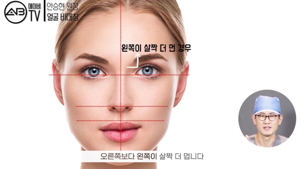 #에이비성형외과 #에이비TV #안면윤곽수술 #비대칭 관련 이미지 3