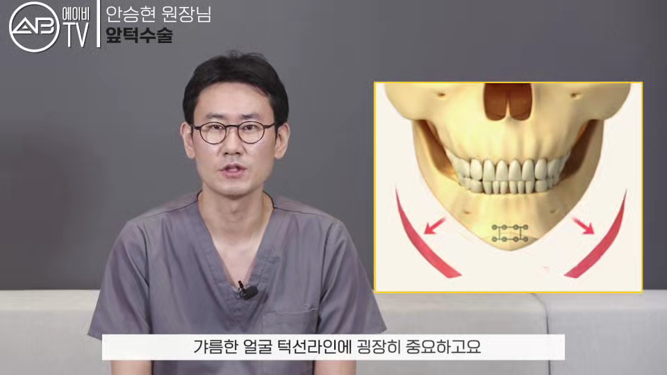 #AB성형외과#유튜브#에이비tv#앞턱수술#턱수술#윤곽수술 관련 이미지 3