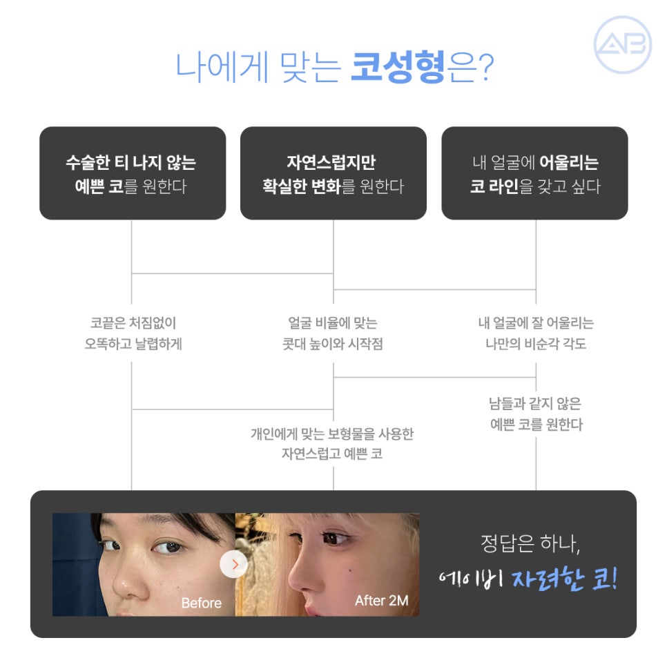 What Are the Special Points of AB Plastic Surgery’s Stylish Nose Surgery? image 2