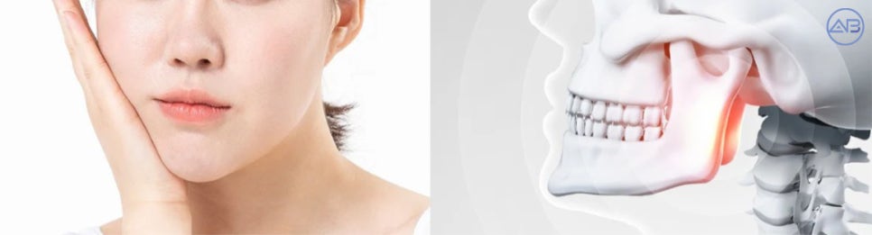 Which Should Be Done First: Facial Contouring Surgery or Orthodontic Treatment? image 2